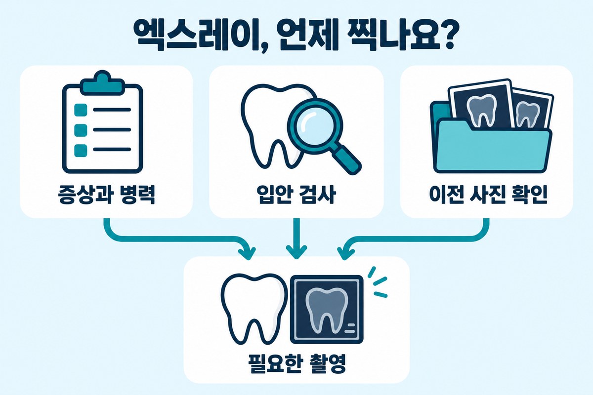 치과 엑스레이의 필요성을 엑스레이, 언제 찍나요?라는 제목 아래 증상과 병력, 입안 검사, 이전 사진 확인으로 설명한 도식입니다.